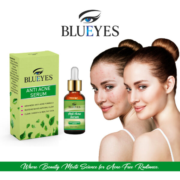 Acne Serum